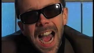 Side Brok – Din likkje drit