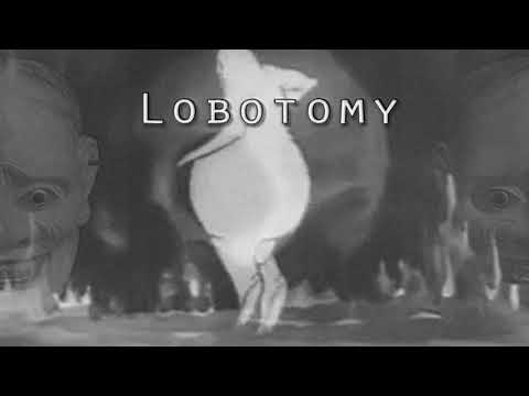 KSLV - Lobotomy