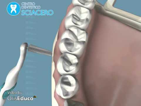 Dolore nella parte sinistra sotto le costole nella parte anteriore e dà alla vita Vertebre inceppata nella colonna vertebrale cervicale