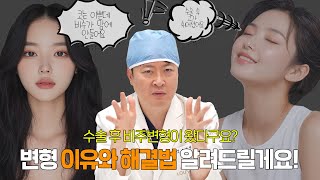 코수술 후 비주 모양이 이상해졌다면, 이 영상부터 보세요!🚨