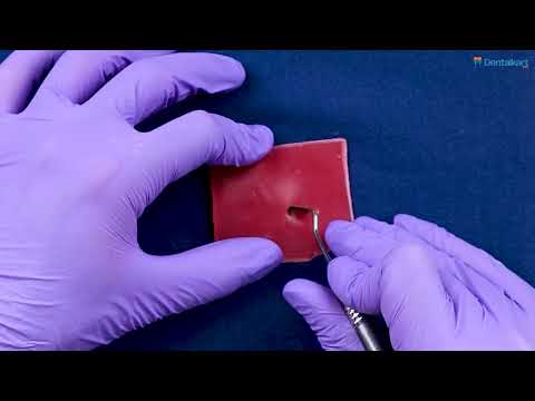 Waldent Periodontal Kirkland Knife 15-16 (15770) #waldent #dentaltools