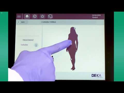 ONDA by DEKA Cellulite Treatment Tutorial