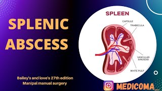 SPLENIC ABSCESS | Etiology, Precipitating Factors, Pathogens, Clinical Features, investigation, Rx