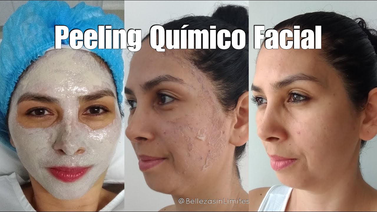 Fedra Polo Garcia-21