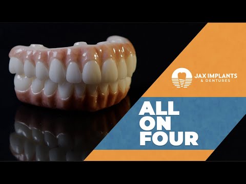 All On 4 Dental Implants. What You Should Know and Cost