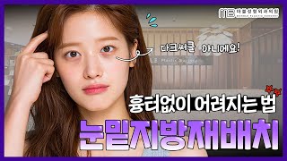 예쁘게 어려지는 눈수술, 눈밑지방재배치의 모든것 (feat.하안검수술과 다른점)