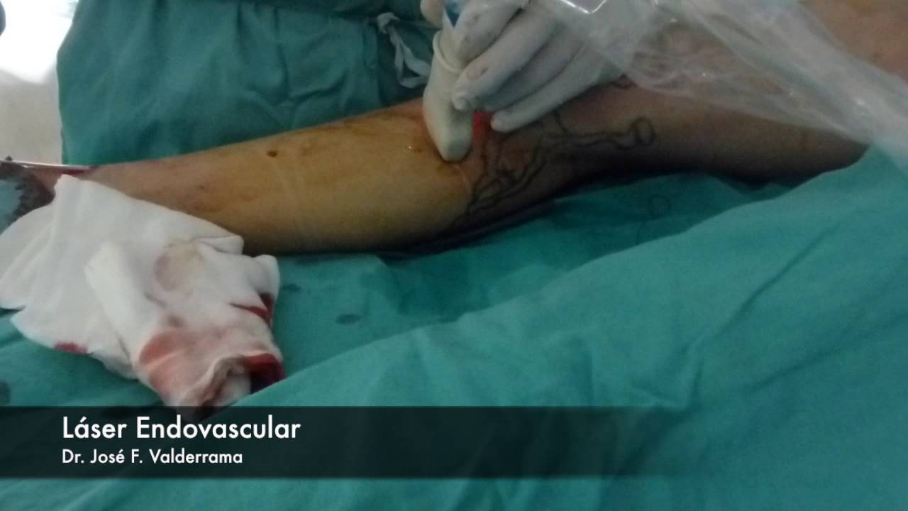 José Francisco Valderrama Marcos-21