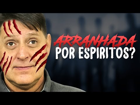 PTD nº 521 - Estão aparecendo arranhões em meus braços, seriam espíritos?