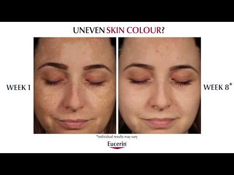 "Eucerin" korektorius nuo pigmentinių dėmių 5ml video