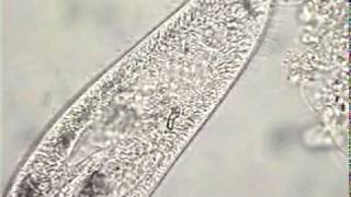 Paramecium Vacuole