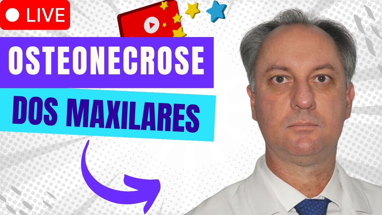 Osteonecrose dos maxilares relacionadas a medicamentos