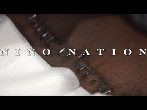 GSB Bari - Nino Nation (MUSIC VIDEO)