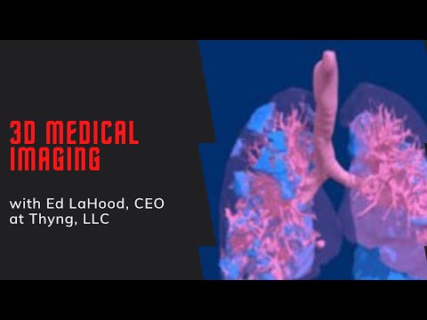 3D Medical Imaging with Ed LaHood, CEO at Thyng, LLC - YouTube