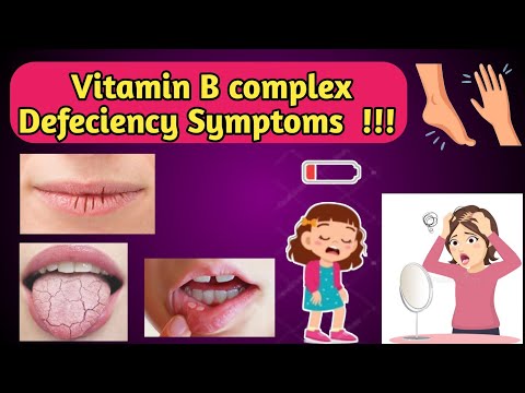 Vitamin B Complex Defeciency Symptoms.