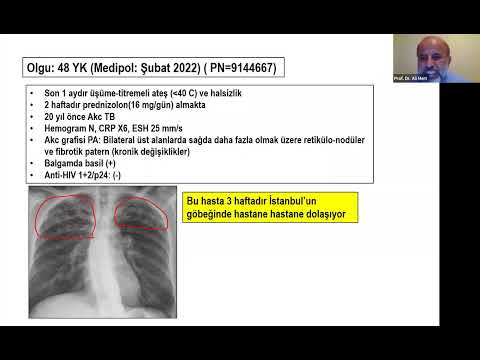 Akciğer Dışı Tüberkiloz