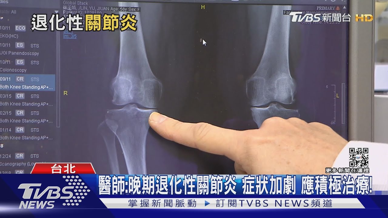 身體「這部位」長期磨損後 嚴重出現變形、劇烈疼痛難行走!