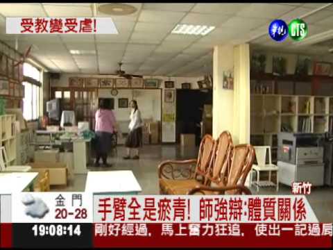 安親班老師打人! 小5生滿手瘀青