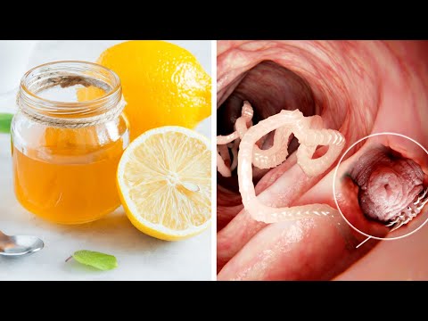 , title : 'Mix Lemon Peel With Honey To Eliminate Intestinal Worms'