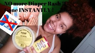 HOW TO GET RID OF DIAPER RASH OVERNIGHT |NATURALLY| |2018|