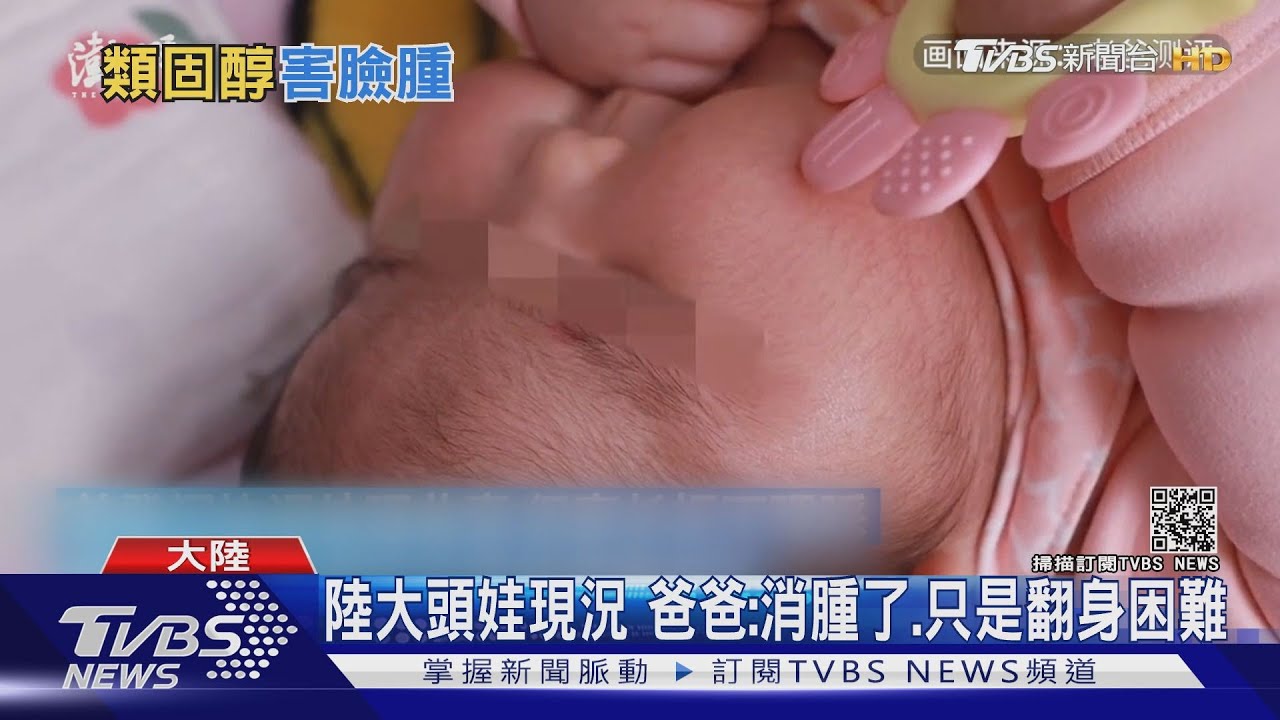 陸「大頭娃」消腫了 福建證實嬰兒霜含激素