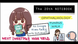 The 20th Notebook || MOST VOLATILE TOPICS || HIGH YIELD NEET PG 2022 || Part 5: FUNDUS WALK