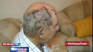 Pareja de ancianos severamente golpeados por asaltantes Pareja de ancianos severamente golpeados por asaltantes