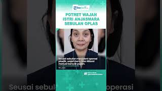 Download lagu Disebut Hasilnya Natural, Intip Potret Dian Nitami seusai Sebulan Operasi Plastik, Tampak Awet Muda mp3