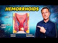 The 1 Best Remedy For Hemorrhoids Dr Berg