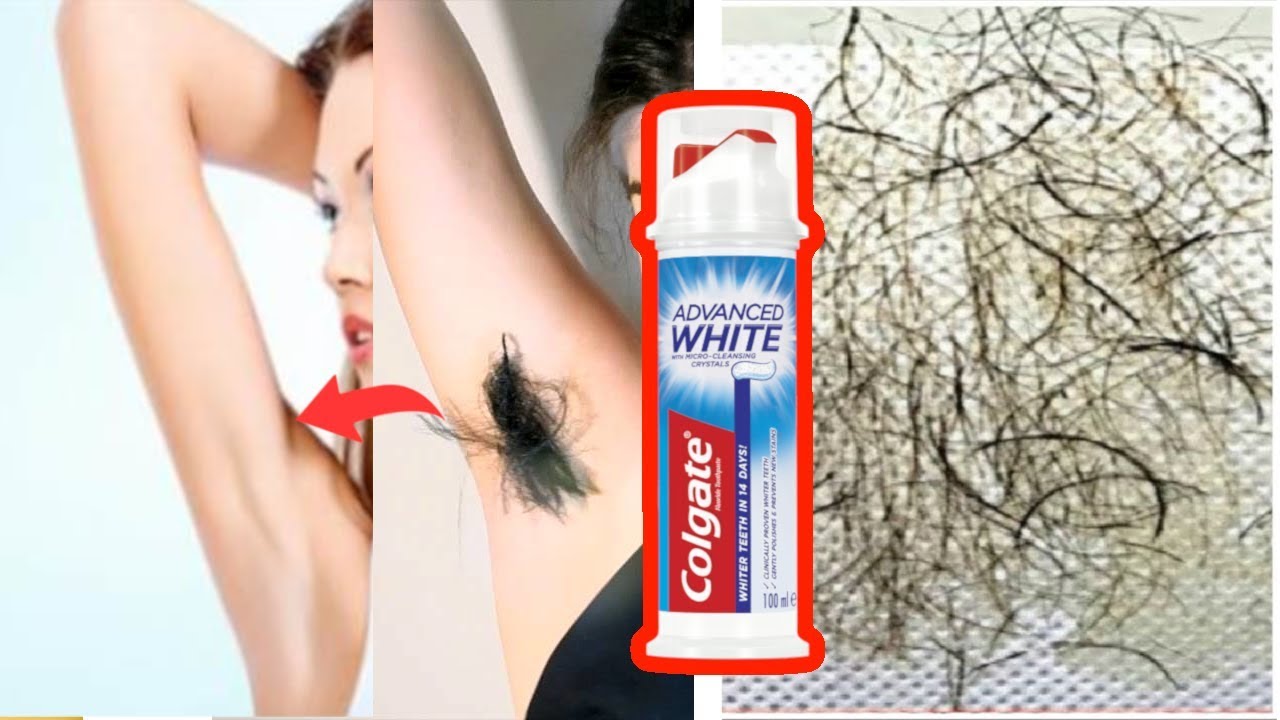 W 5 Minut Usuń Niepotrzebne Włosy Na Stałe BEZ Woskowania, BEZ Golenia