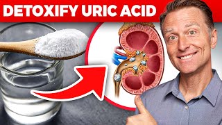 Detoxify Uric Acid From Kidneys – Uric Acid Gout & Kidney Stones – Dr. Berg On Kidney Cleanse