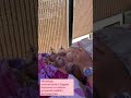 Cupping Therapy Helped Me A Lot Littleglove Ashortaday Shorts