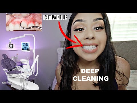 YouTube video about: How painful is a deep cleaning?