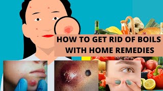 HOW TO GET RID OF BOILS WITH HOME REMEDIES