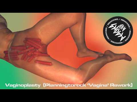 {Vaginoplasty} {Vaginoplasty} Best Songs