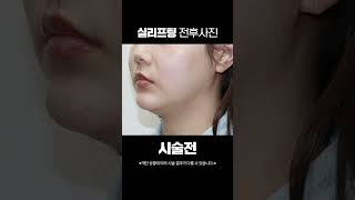 대한의료신문 Today 병의원 탐방 ep158 : 청담디어의원