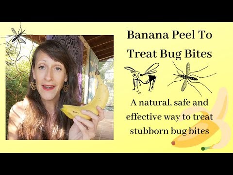 download lagu mp3 mp4 Banana Peel Itch Relief, download lagu Banana Peel Itch Relief gratis, unduh video klip Banana Peel Itch Relief