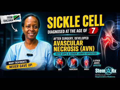 Sickle Cell Disease & #AVN Recovery | Remarkable Improvement Through Regenerative Treatment in India