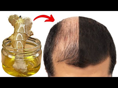🔥This recipe will make your hair grow like crazy! Hair growth remedies!