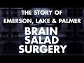 Emerson Lake & Palmer - Story of Brain Salad Surgery Documentary