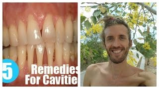 How To Heal Cavities, Strengthen And Remineralize Teeth & Bones, Ligaments, Joints, Flesh & Tendons