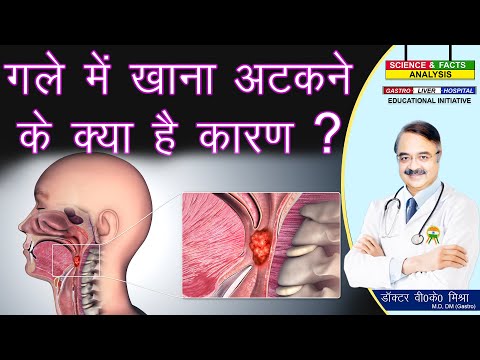 गले में खाना अटकने के क्या है कारण ? || DYSPHAGIA DIFFICULTY IN SWALLOWING WHAT ARE THE CAUSES