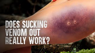 Worst Things To Do When Bitten by a Snake