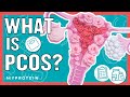 What Is PCOS? Nutrition & Exercise Advice | Nutritionist Explains.. | Myprotein