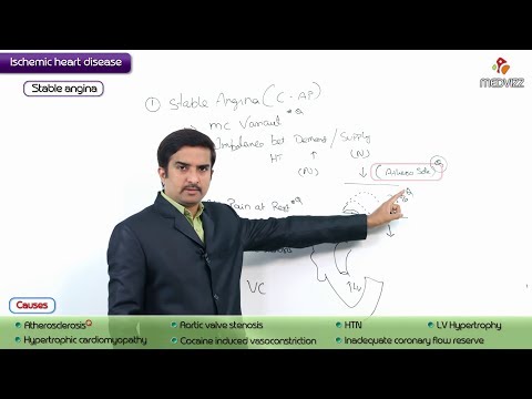 Pathology of Angina Pectoris : Stable Angina - USMLE Step 1 coronary artery disease