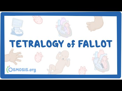 Tetralogy of Fallot (Year of the Zebra)
