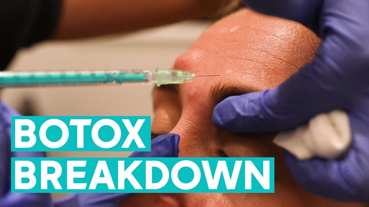 Botox Breakdown: Myths, facts, & when you should start | Glam Lab