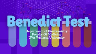 Benedict’s Test Step-by-Step