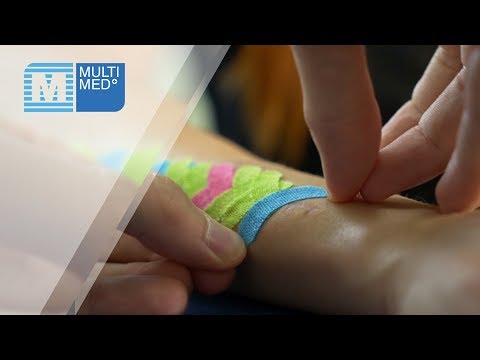 Toczeń rumieniowaty, i wypadanie włosów Skuteczny środek przeciw wypadaniu włosów po porodzie