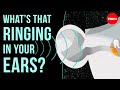 What's that ringing in your ears? - Marc Fagelson