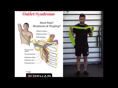 7 Exercises for Thoracic Outlet Syndrome